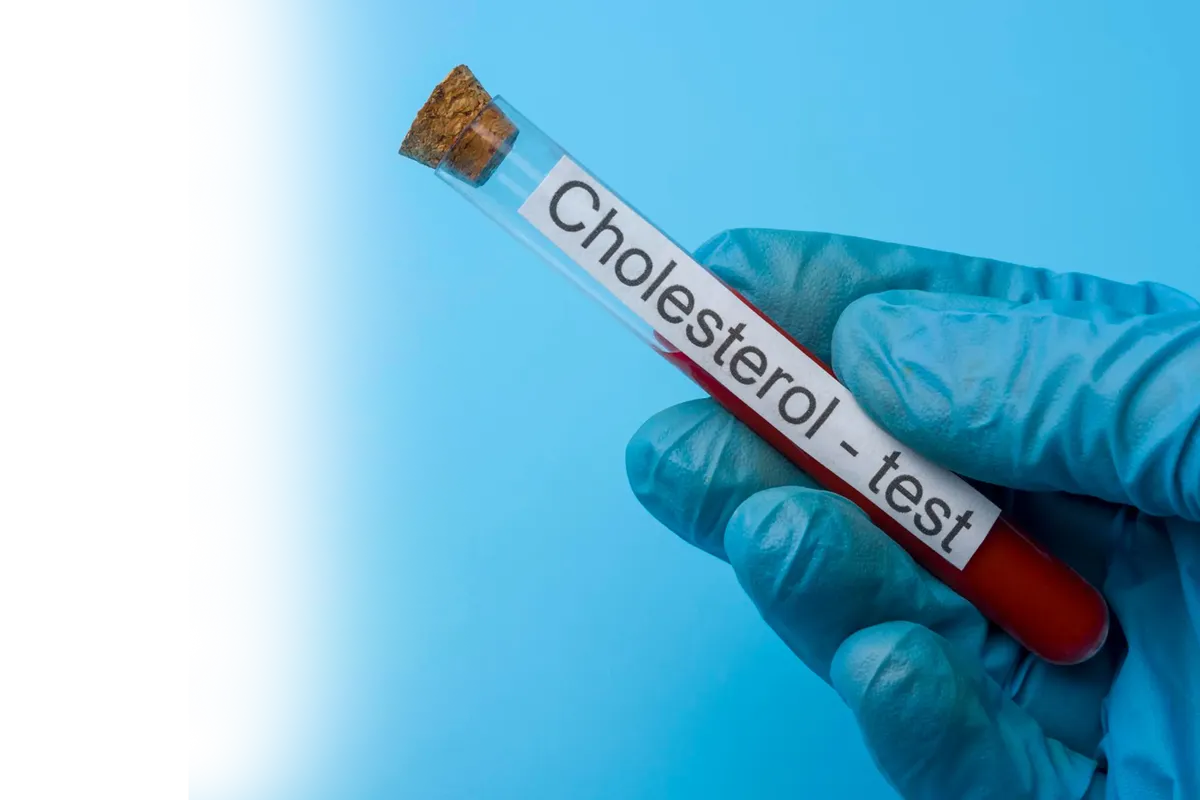 Χέρι με μπλε ιατρικό γάντι που κρατά σωλήνα εξέτασης αίματος χοληστερόλης σε γαλάζιο φόντο